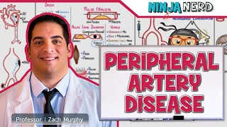 Peripheral Artery Disease [upl. by Amsed149]