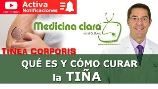 Tiña ¿como curar la tiña Síntomas tratamiento explicación  Medicina Clara [upl. by Nino]