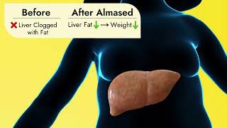 Almased Unclogs Liver from Fat [upl. by Ahsekin742]