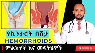 Ethiopia  የኪንታሮት በሽታ ምልክቶች እና መፍትሄዎች Hemorrhoids [upl. by Ellenor]