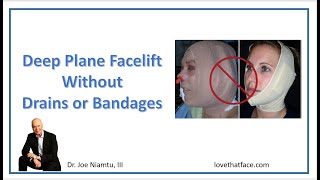 Deep Plane Facelift Without Drains or Bandages [upl. by Siger]