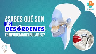 ¿Sabes qué son los desórdenes temporomandibulares  Tu Salud Guía [upl. by Yrahca148]