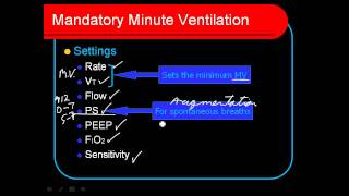 Mandatory Minute Ventilation MMV [upl. by Cohla]