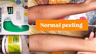 Normal peeling on handremove dark spots and tanningjovees skincare viralvideo [upl. by Huntingdon]