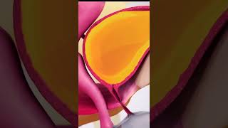 Urinary incontinence causes and symptoms 3danimation medicalanimation [upl. by Atilrac]