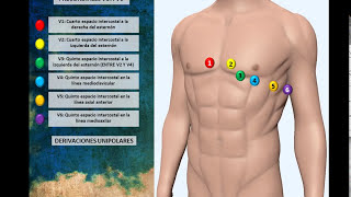 Electrocardiograma 01 Colocación Correcta de Electrodos [upl. by Nyssa]