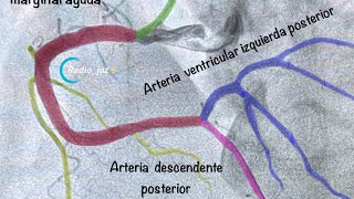 Aprende a diferenciar la coronaria derecha [upl. by Rimisac881]