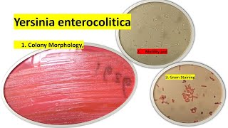 Yersinia enterocolitica colony Morphology Motility and Gram Staining [upl. by Annaoy]