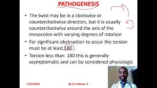 Volvulussigmoidcecaltransverse colonsplenic flexture part I by dr Tadesse fenta [upl. by Wilson]