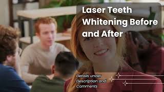 Laser Teeth Whitening Before and After [upl. by Euqinamod]