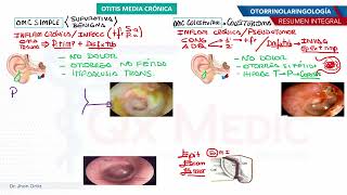 Otorrinolaringología  OMC [upl. by Ettegirb]