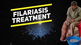 filariasis treatment [upl. by Eilra]