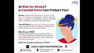 Reduce Stroke Risk with Carotid Stenting [upl. by Tham]