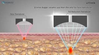 UTIMS A3 Transducer for Fat Reduction HIFU [upl. by Nova578]