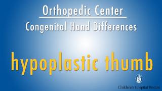 hypoplastic thumb  congenital hand differences  Boston Childrens Hospital [upl. by Arraeic]