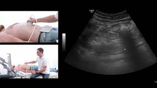 How to perform an ultrasound exam of the pancreas [upl. by O'Dell]