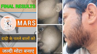 BEARD GROWTH □ Final results from mars by ghc minoxidil  दाढ़ी को जल्दी मोटा बनाये 100 [upl. by Adnawat]