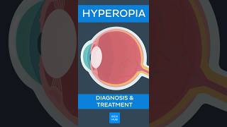 Hyperopia Diagnosis amp treatment  Kenhub hyperopia [upl. by Tteltrab214]