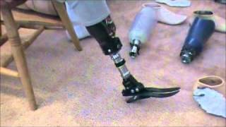 prosthetic leg assembly Echelon  Perfect StrideUltra Strideflex foot [upl. by Madelle]