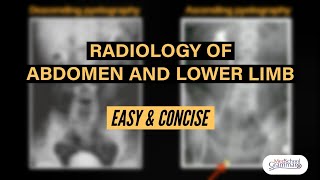 Radiological Anatomy of Abdomen and Lower Limb  Easy and Concise  Exam Oriented [upl. by Lav]