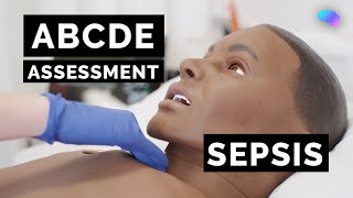 ABCDE Assessment  Sepsis  Emergency Simulation Scenario  OSCE Guide  UKMLA  CPSA [upl. by Nnayd86]