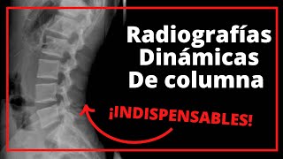 Diagnóstico de un problema de columna Radiografías Dinámicas [upl. by Uria22]