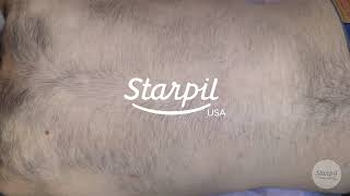 How to Wax Mens Back Hair  Full Back Hair Removal  Starpil Wax [upl. by Darwin]