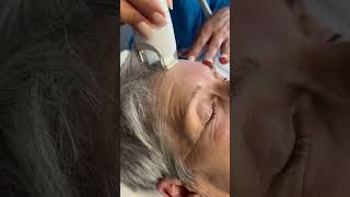 Antiaging face treatment AntiAging Lahore Faceprp acnesolution acnetreatment facetreatment [upl. by Reggy]