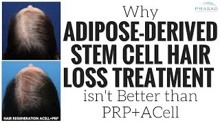 Why Adipose Derived Stem Cell Hair Loss Treatment has No Advantage over ACellPRP [upl. by Peadar333]