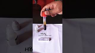 hbsag test  hbsag positive test  hbsag test kya hota hai  shorts  youtubeshorts  hbsag [upl. by Naanac]