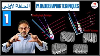 Taking Periapical Radiographs  I نصائح هامة لتصوير اشعة الأسنان آثناء علاج أقنية الجذور [upl. by Emoreg517]