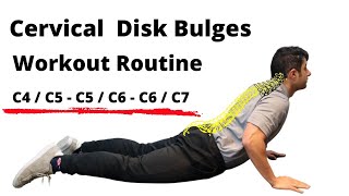 Workout routine for Cervical Disc Bulges  Beginner Level [upl. by Rehpotsrihc956]