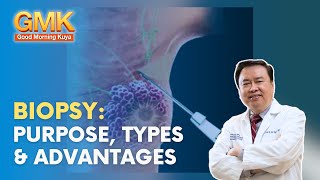 BIOPSY Purpose Types amp Advantages  Usapang Pangkalusugan [upl. by Skye]