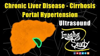 Chronic Liver Disease  Cirrhosis  Portal Hypertension  Portosystemic Collaterals  Imaging Study [upl. by Ali]