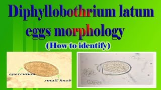 Diphyllobothrium latum eggs morphology How to identify [upl. by Pulling]