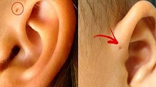 A Tiny Extra Sign In Someones Ear And Wondered What It Was [upl. by Chong]