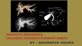 MRCP MAGNETIC RESONANCE COLANGIOPANCREATOGRAPHY  BY  AISHWARYA MISHRA [upl. by Pall]