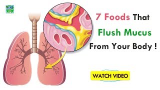 7 Foods That Flush Mucus From Your Body  Home Remedies [upl. by Berky436]