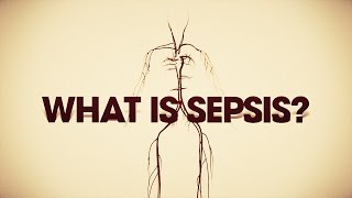 What is sepsis Heres what you need to know [upl. by Jonette267]