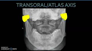 Anatomía Radiológica Columna Cervical 2 [upl. by Anelam466]