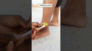 🔥Get Rid of Dry cracked Feet skincareskincaretips skincareroutine snmakeuptutoria crackedhand [upl. by Ghiselin670]