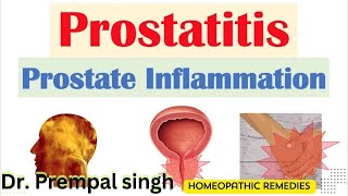 Prostatitis Symptoms and Other Related Complaintsपेशाब में खून जलनव बूंद बूंद आना Best medicine [upl. by Toomin867]