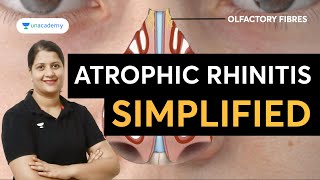 Atrophic Rhinitis Simplified  ENT with Dr Vyshnavi Jajee [upl. by Leda]