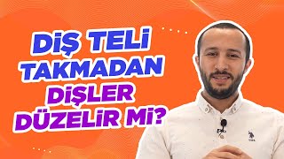 Şeffaf Plak Tedavisi Nedir  Ortodontist Necati Türkmen [upl. by Ydderf]