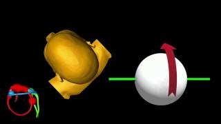 Eye Movement in Left Posterior Canal BPPV [upl. by Eleonora443]