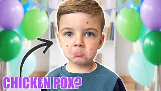 LOGANS Birthday VLOG will it be a CHICKEN POX party [upl. by Airpal]