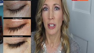 Grow Longer Lashes RapidLash Review  Latisse Comparison [upl. by Aibara]