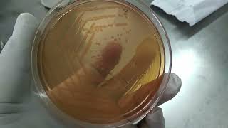 Aeromonas hydrophila Colony Morphology on Macconkey Medium and Biochemical Tests in TSI MIU and Cit [upl. by Gebelein]