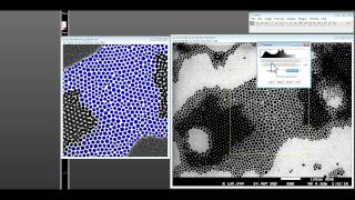 How to use ImageJ for nanoparticle size distribution analysis [upl. by Olmstead]