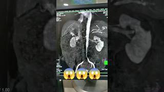 MRI scan radiologycareer trebding trend trendalert viralshort viral viralreels viralvideo [upl. by Gravante]